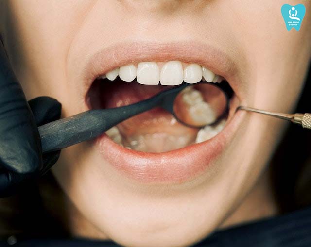 trồng răng implant tại tphcm