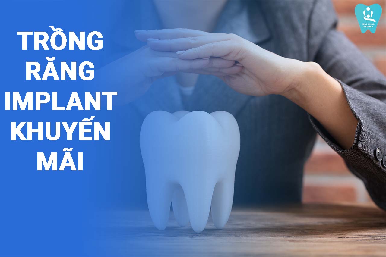 trồng răng implant khuyến mãi