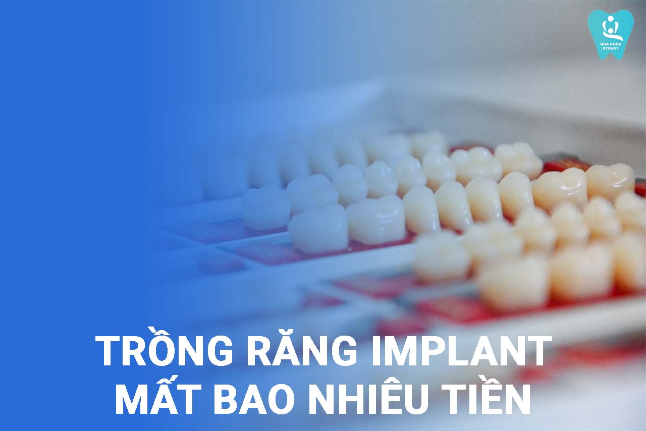 trồng răng implant mất bao nhiêu tiền